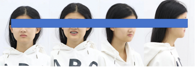 0cc0c2f1194d3924d3182abc54aace1.png